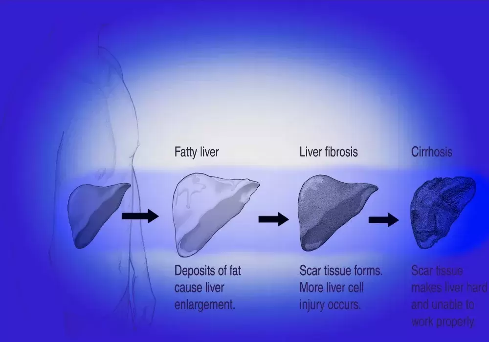 Sullivan's Charbroil